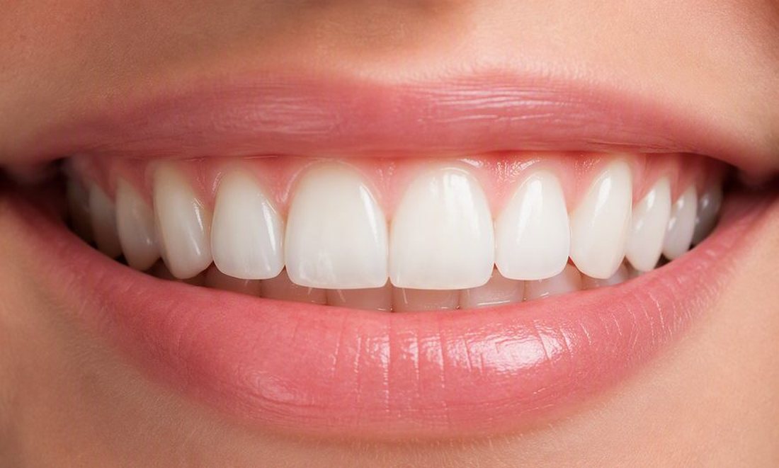 Close-up de sorriso com contorno gengival harmonioso e dentes naturais