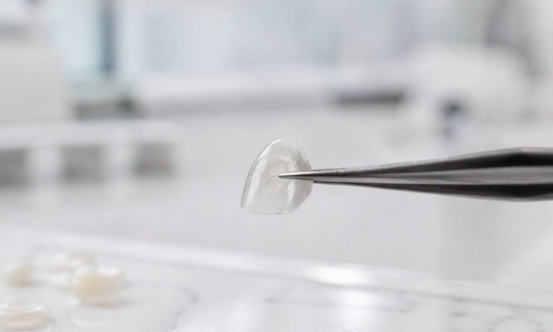 Lente de contato dental ultrafina de porcelana segurada por pinça de precisão