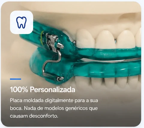 Placa de avanço mandibular sobre modelo das arcadas — moldada digitalmente para a boca de cada paciente, sem modelos genéricos