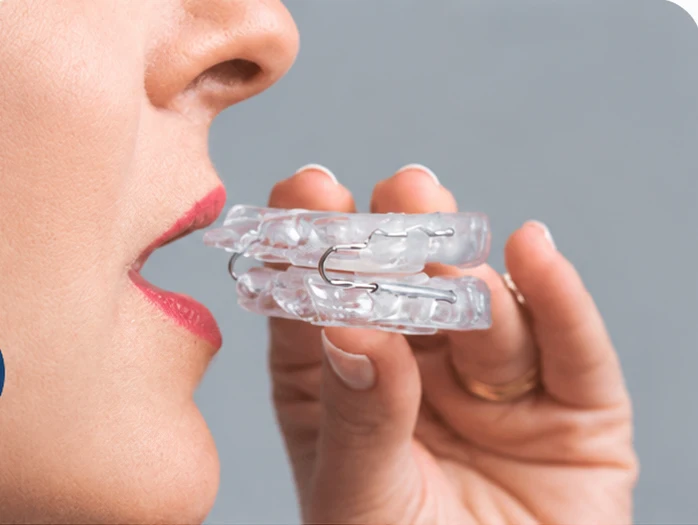 Placa antirronco transparente de avanço mandibular segurada na mão
