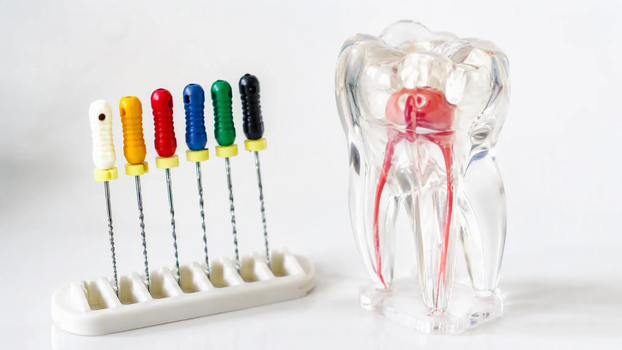 Comparação entre tratamento de canal e extração dentária